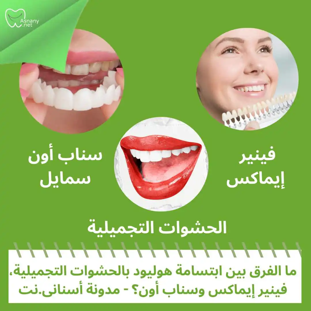 الفرق بين الحشوات التجميلية، فينير ايماكس وسناب اون سمايل.