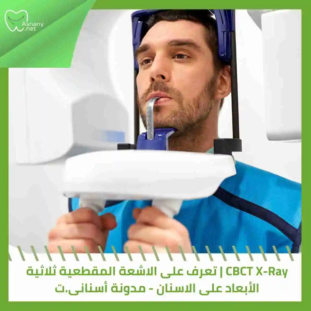 CBCT X-Ray | تعرف على الاشعة المقطعية ثلاثية الأبعاد على الاسنان