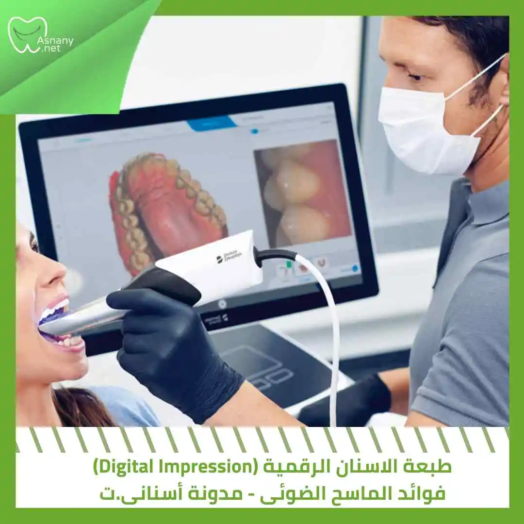 طبعة الاسنان الرقمية (Digital Impression) |فوائد الماسح الضوئى