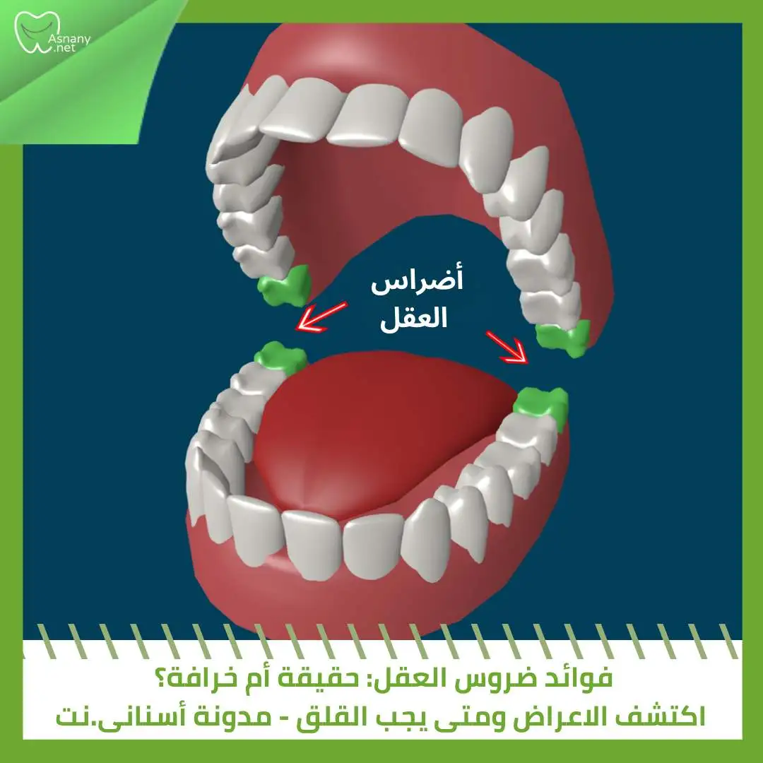 فوائد ضرس العقل: حقيقة أم خرافة؟ اكتشف الاعراض ومتى يجب القلق