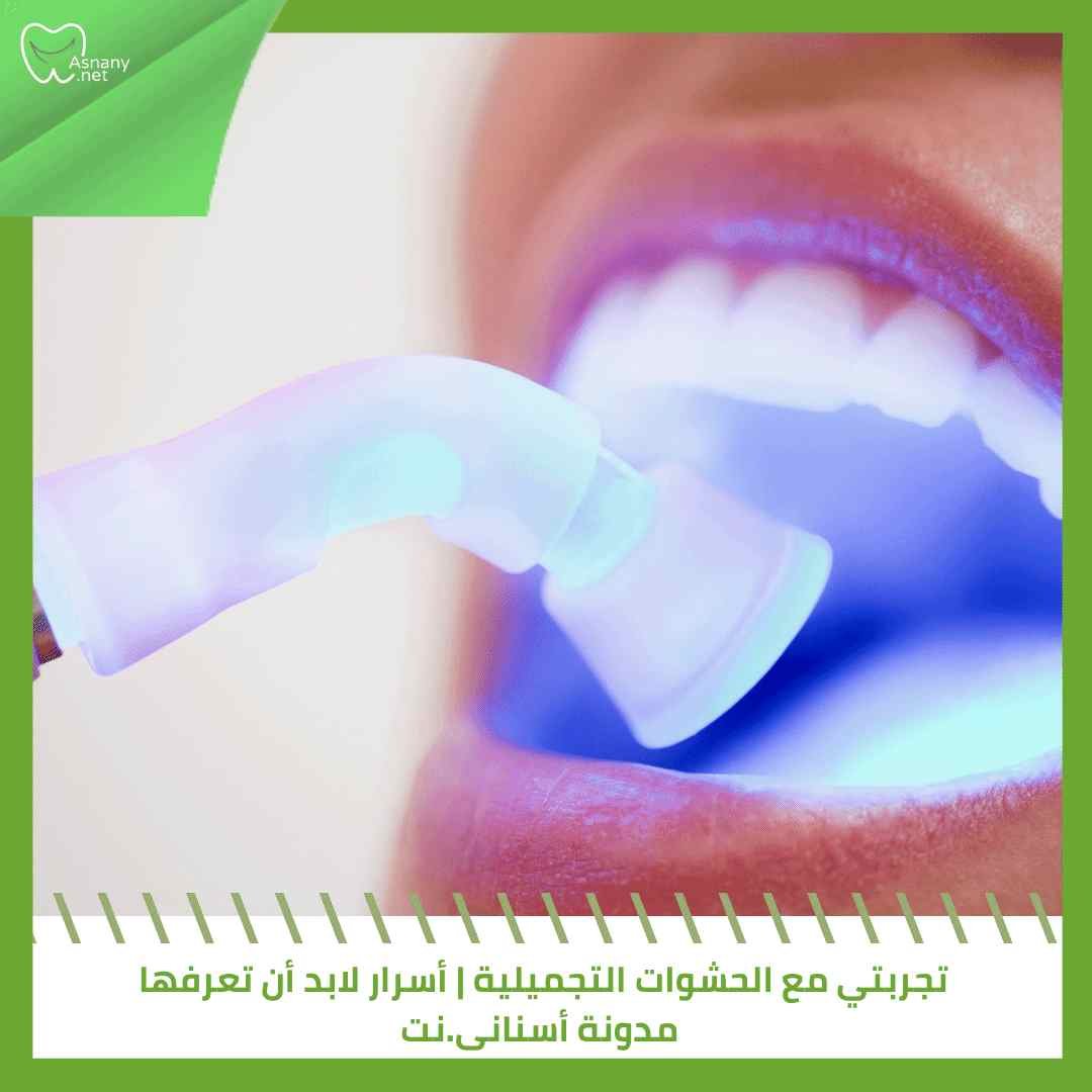 تجربتي مع الحشوات التجميلية | أسرار لابد أن تعرفها