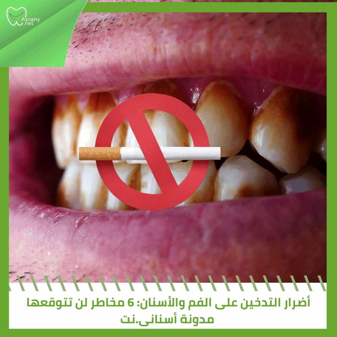 أضرار التدخين على الفم والأسنان: 6 مخاطر لن تتوقعها