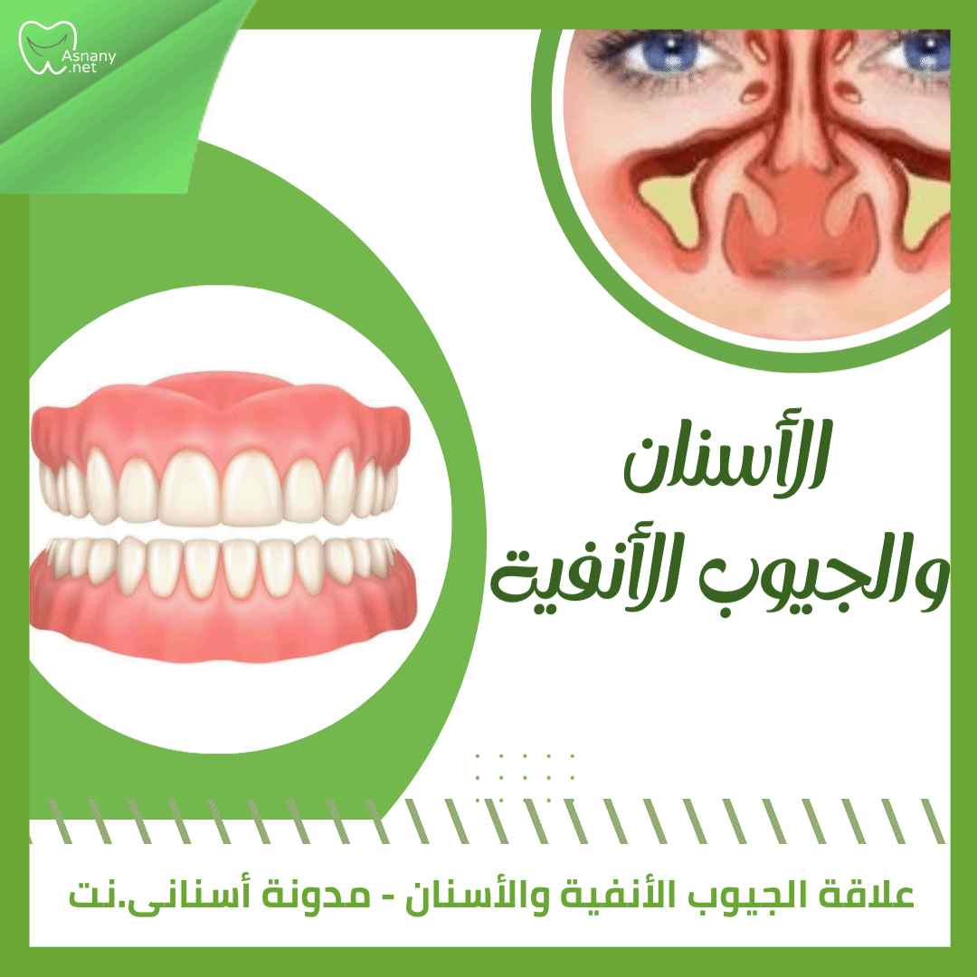 علاقة الجيوب الأنفية والأسنان 
