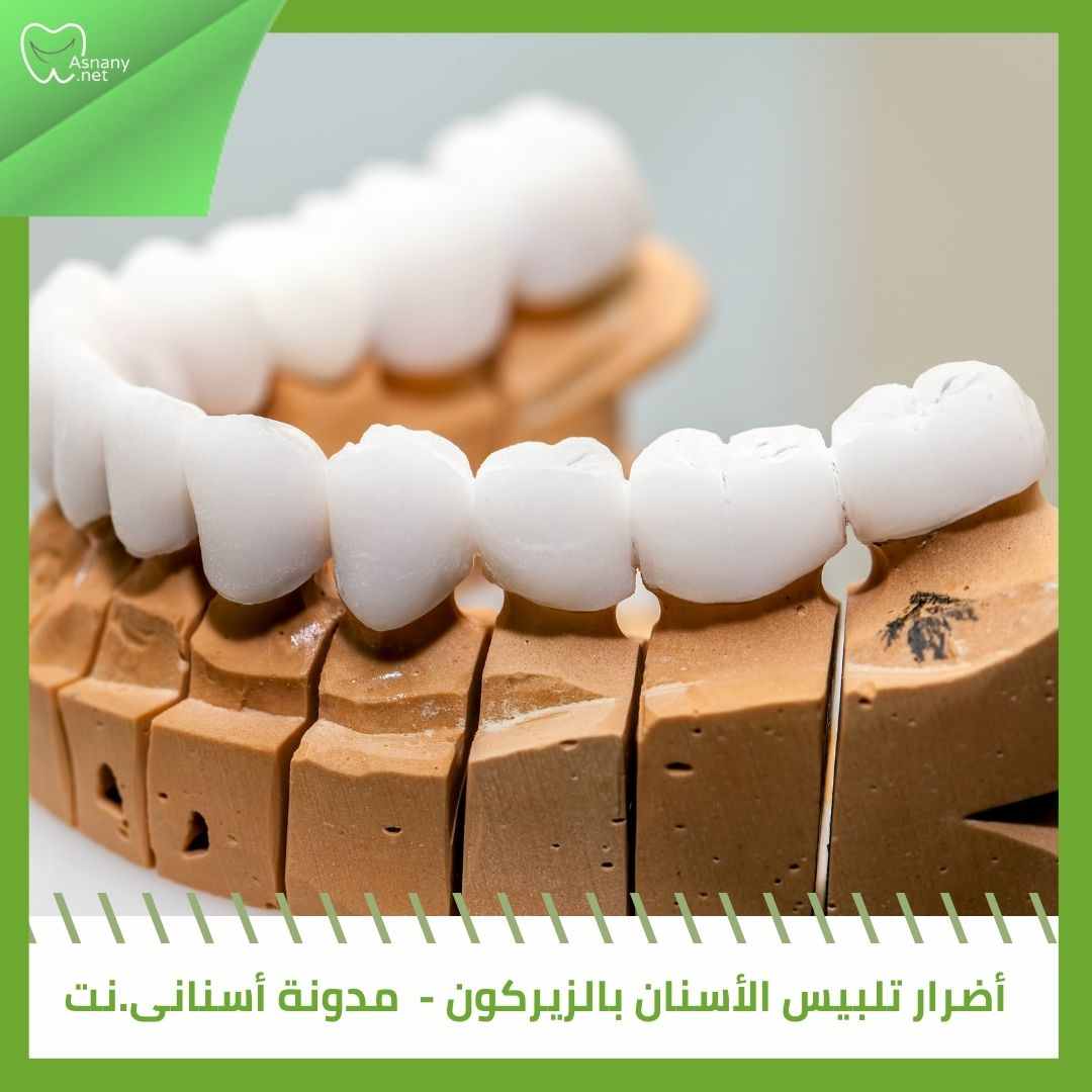 أضرار تلبيس الأسنان بالزيركون