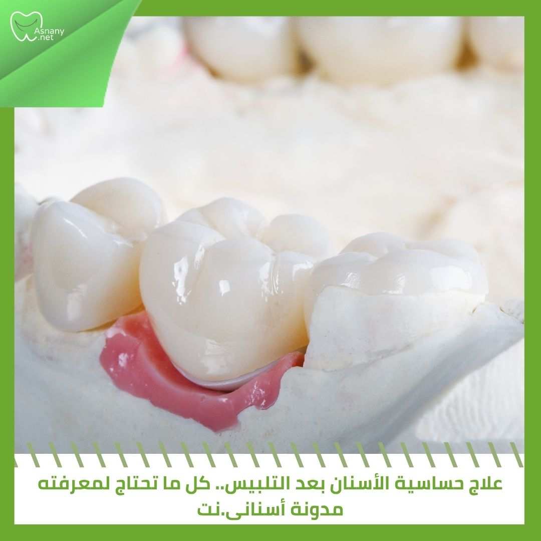 علاج حساسية الأسنان بعد التلبيس.. كل ما تحتاج لمعرفته