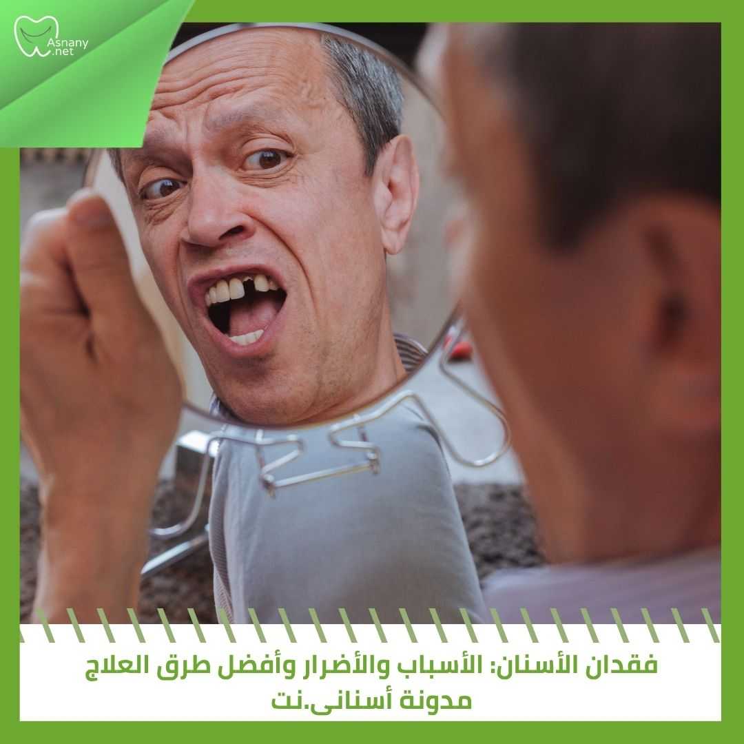 فقدان الأسنان: الأسباب والأضرار وأفضل طرق العلاج  